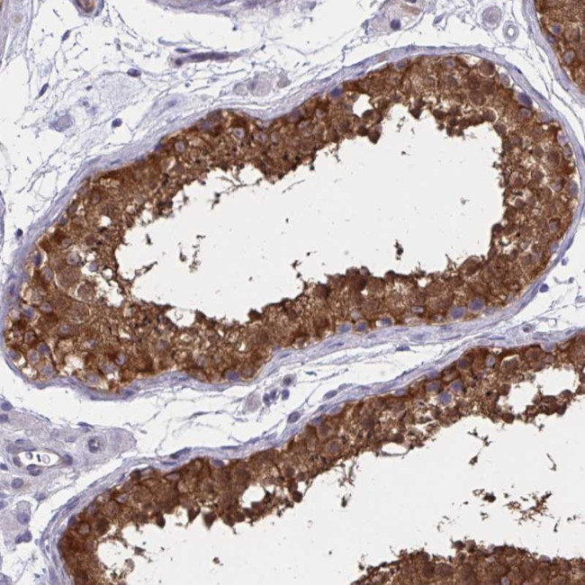 ADAMTSL1 Antibody in Immunohistochemistry (Paraffin) (IHC (P))