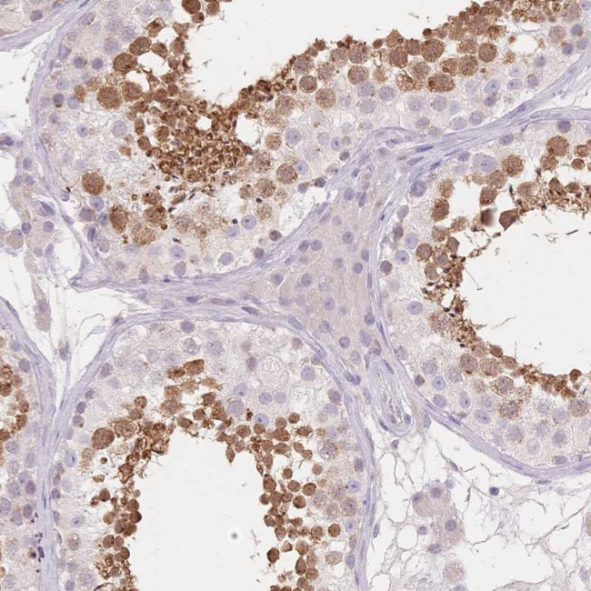 SUV39H2 Antibody in Immunohistochemistry (Paraffin) (IHC (P))