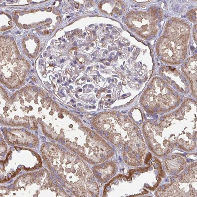 ISCU Antibody in Immunohistochemistry (IHC)