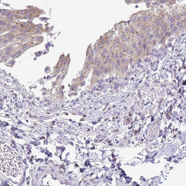 VPS4B Antibody in Immunohistochemistry (Paraffin) (IHC (P))