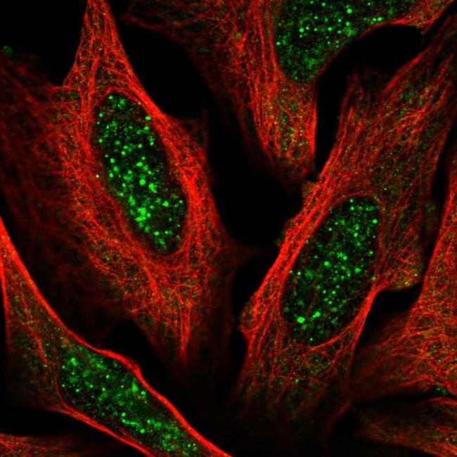 ACD Antibody in Immunocytochemistry (ICC/IF)