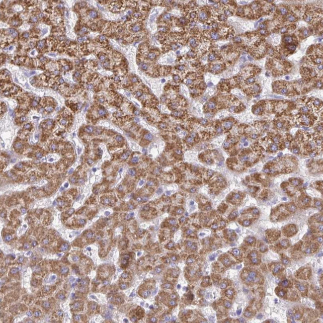 ACSM2A Antibody in Immunohistochemistry (Paraffin) (IHC (P))