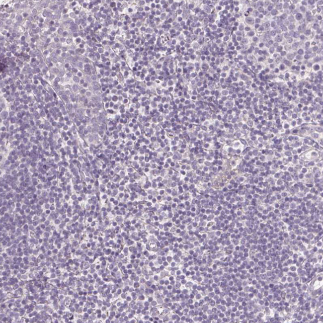 CYP11B2 Antibody in Immunohistochemistry (Paraffin) (IHC (P))