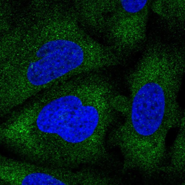 NAA30 Antibody in Immunocytochemistry (ICC/IF)