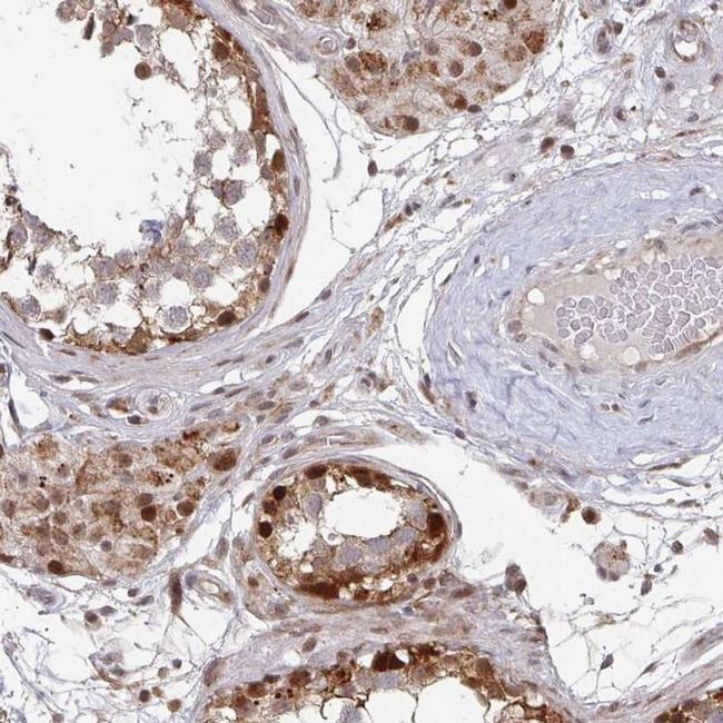 RBBP5 Antibody in Immunohistochemistry (IHC)