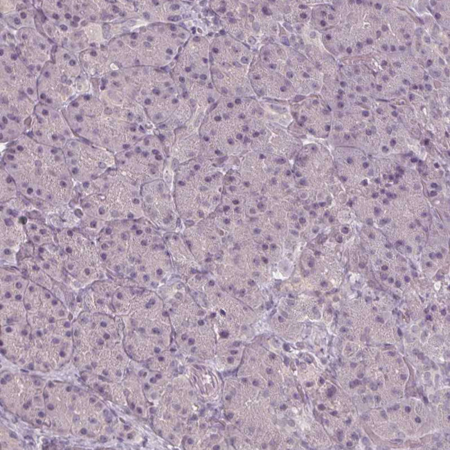 SLC26A2 Antibody in Immunohistochemistry (Paraffin) (IHC (P))