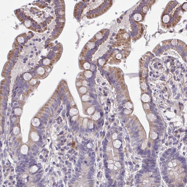 CEP63 Antibody in Immunohistochemistry (Paraffin) (IHC (P))