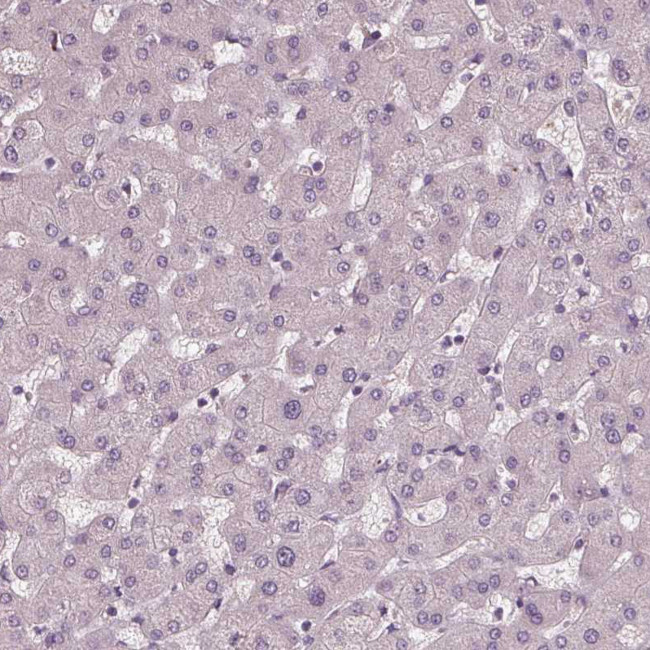 DNAH12 Antibody in Immunohistochemistry (Paraffin) (IHC (P))