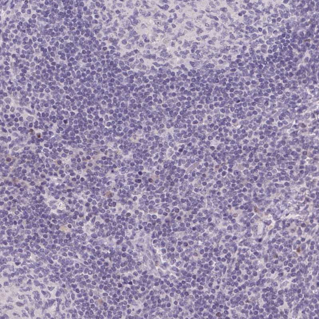 Triadin Antibody in Immunohistochemistry (Paraffin) (IHC (P))