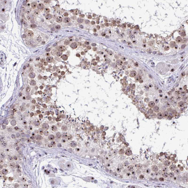 CEP72 Antibody in Immunohistochemistry (Paraffin) (IHC (P))