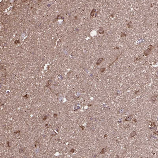 ACOT6 Antibody in Immunohistochemistry (Paraffin) (IHC (P))