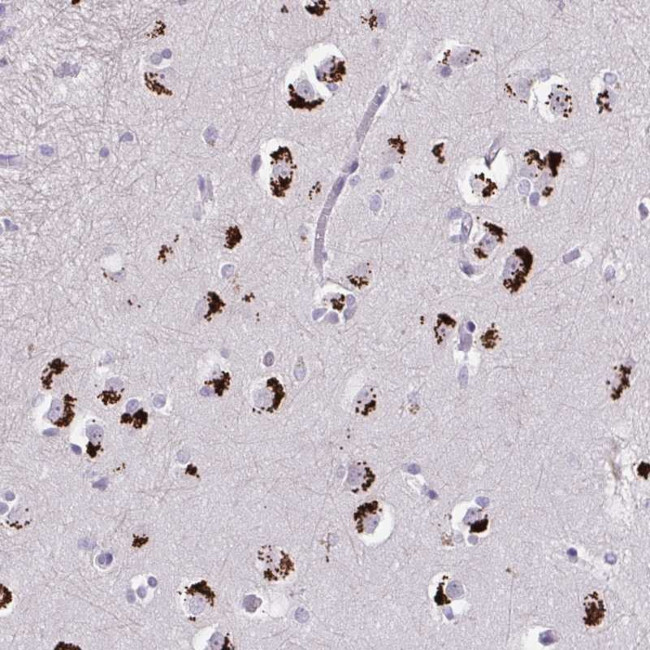 GLTPD2 Antibody in Immunohistochemistry (Paraffin) (IHC (P))