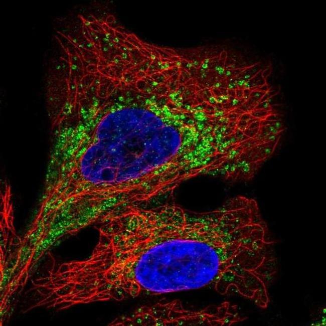 TMEM106B Antibody in Immunocytochemistry (ICC/IF)