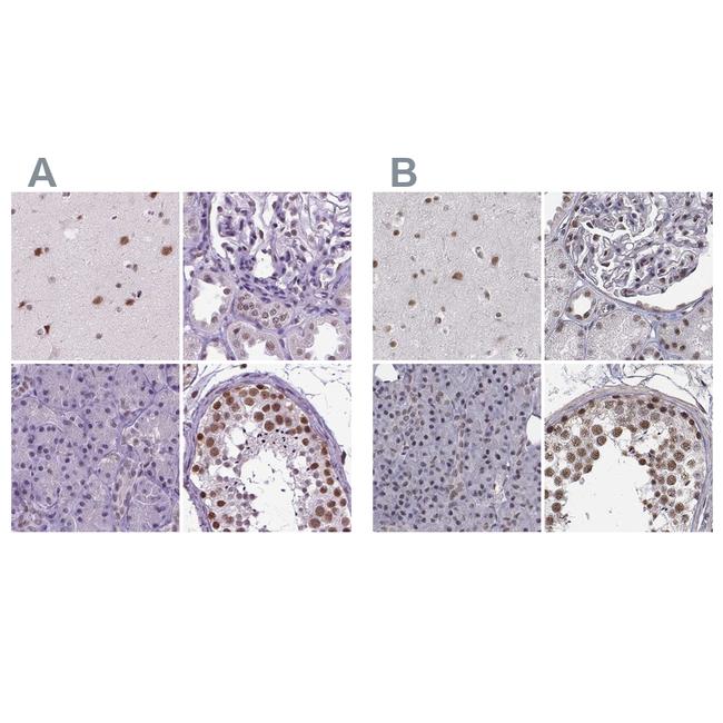 SETD1A Antibody in Immunohistochemistry (IHC)