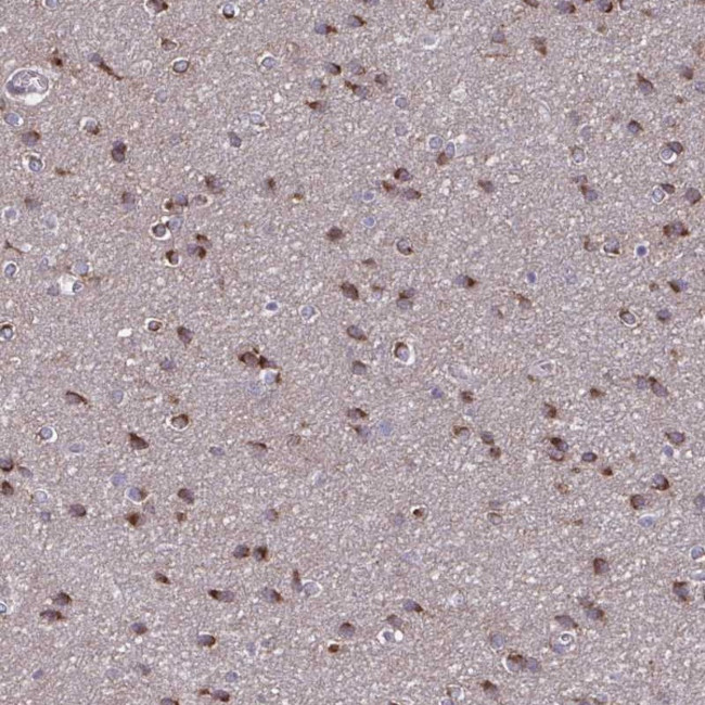 NUMBL Antibody in Immunohistochemistry (Paraffin) (IHC (P))