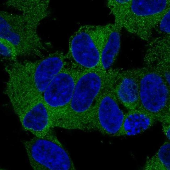 KIF21A Antibody in Immunocytochemistry (ICC/IF)