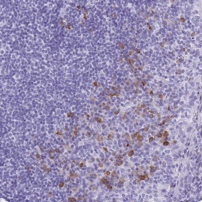 Bestrophin 4 Antibody in Immunohistochemistry (Paraffin) (IHC (P))