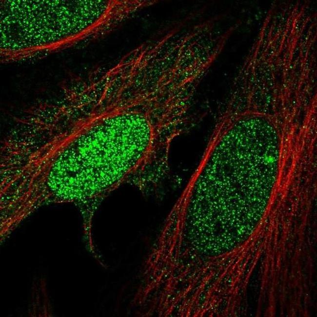 HMBOX1 Antibody in Immunocytochemistry (ICC/IF)