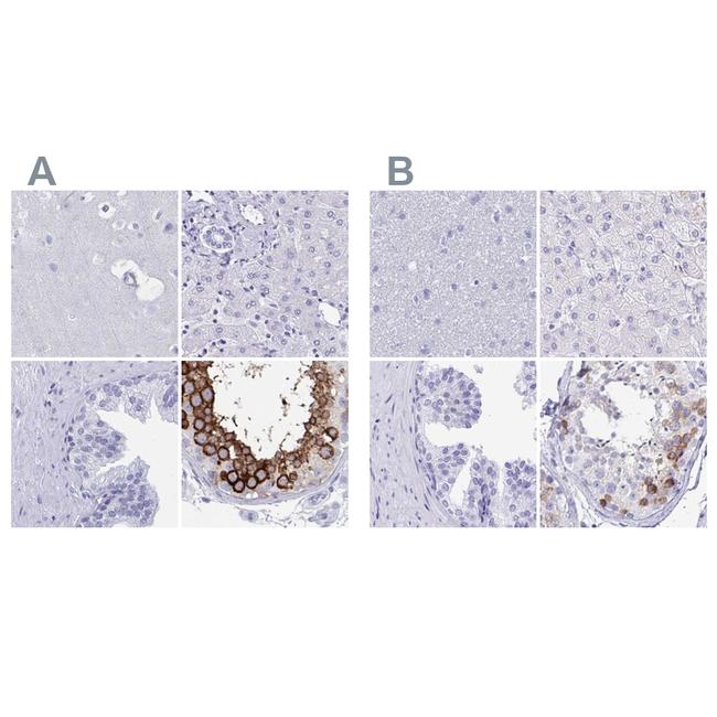 DPEP3 Antibody in Immunohistochemistry (IHC)