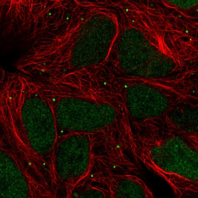 TIPIN Antibody in Immunocytochemistry (ICC/IF)