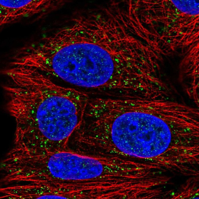 AACS Antibody in Immunocytochemistry (ICC/IF)