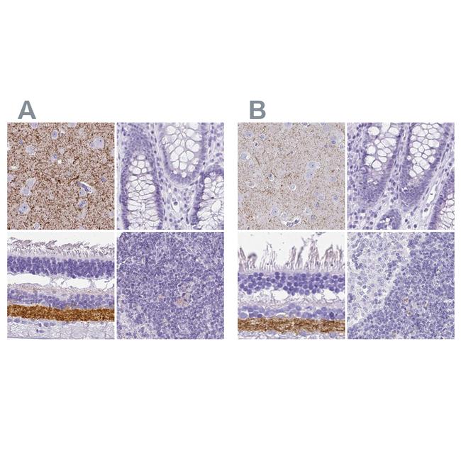 VGAT Antibody in Immunohistochemistry (IHC)