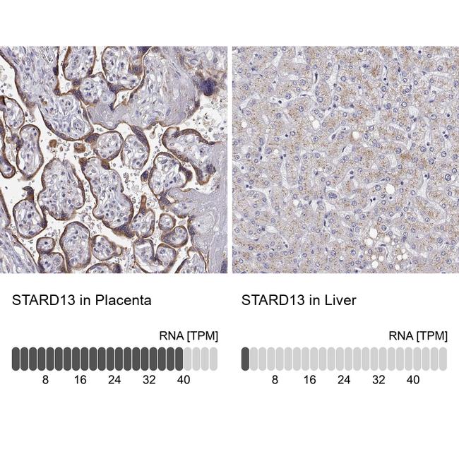 STARD13 Antibody in Immunohistochemistry (IHC)