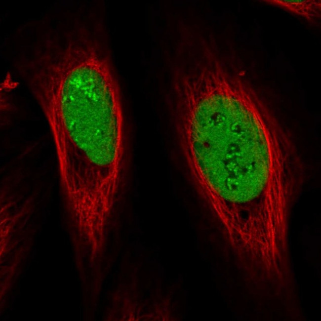 NOLA1 Antibody in Immunocytochemistry (ICC/IF)