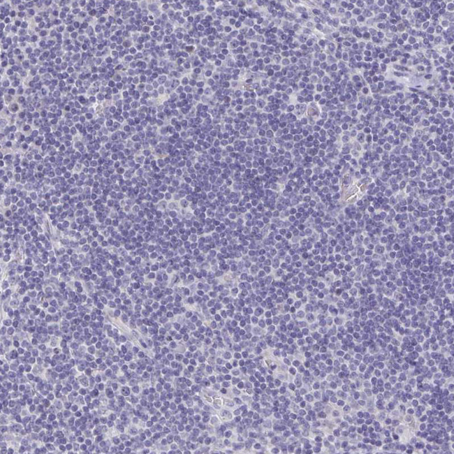 OR10K1 Antibody in Immunohistochemistry (Paraffin) (IHC (P))