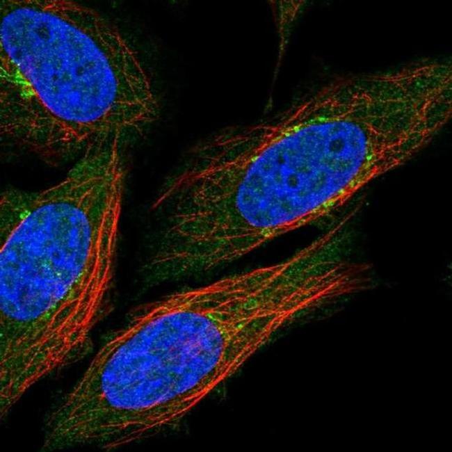 NNMT Antibody in Immunocytochemistry (ICC/IF)