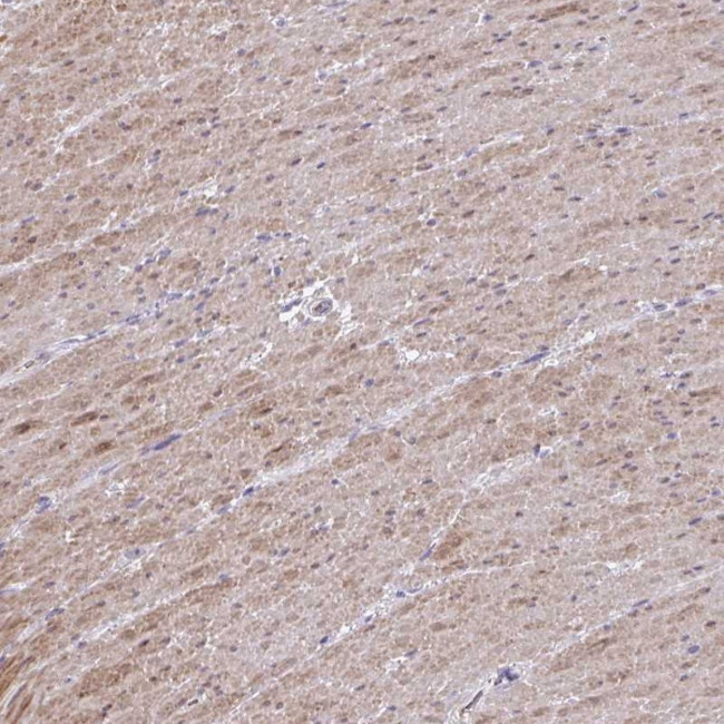 MYL12A Antibody in Immunohistochemistry (Paraffin) (IHC (P))