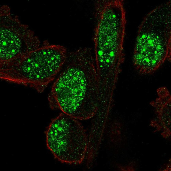 NOLA3 Antibody in Immunocytochemistry (ICC/IF)