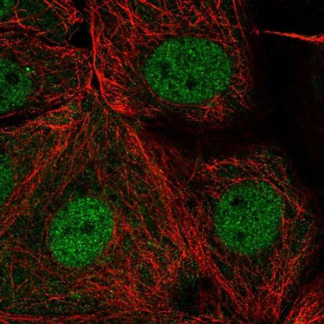 PSD Antibody in Immunocytochemistry (ICC/IF)