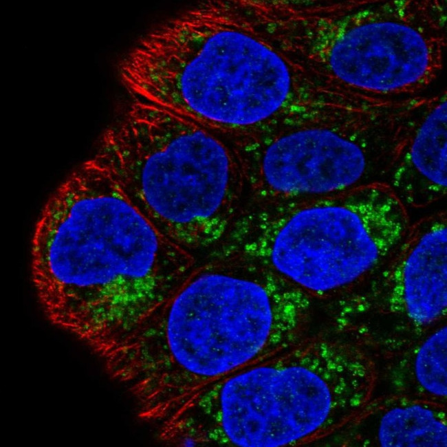 MAOA Antibody in Immunocytochemistry (ICC/IF)