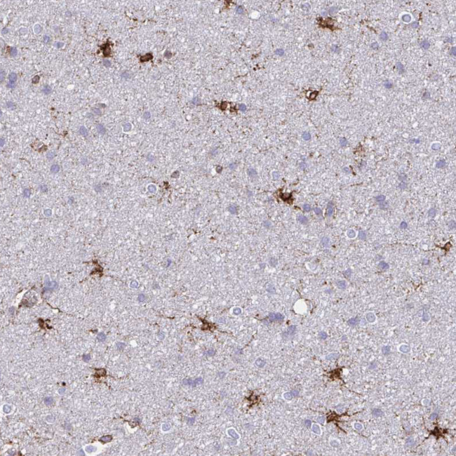 ASPH Antibody in Immunohistochemistry (Paraffin) (IHC (P))