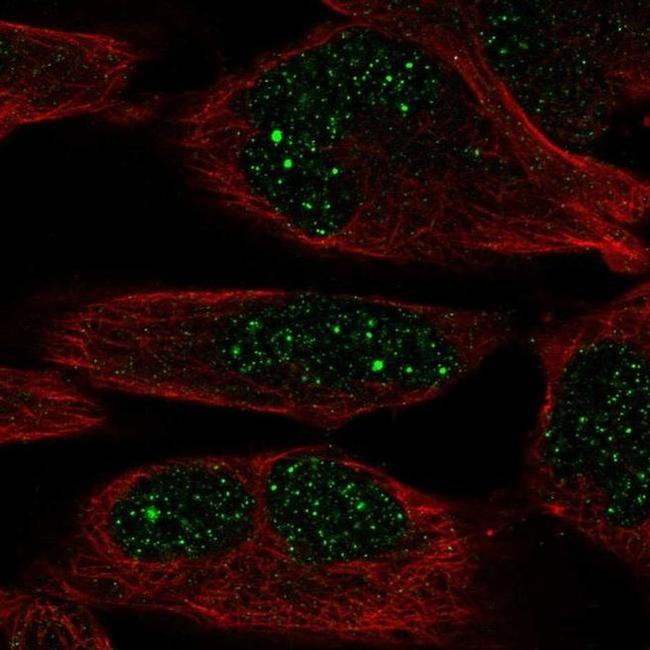 ZNF221 Antibody in Immunocytochemistry (ICC/IF)