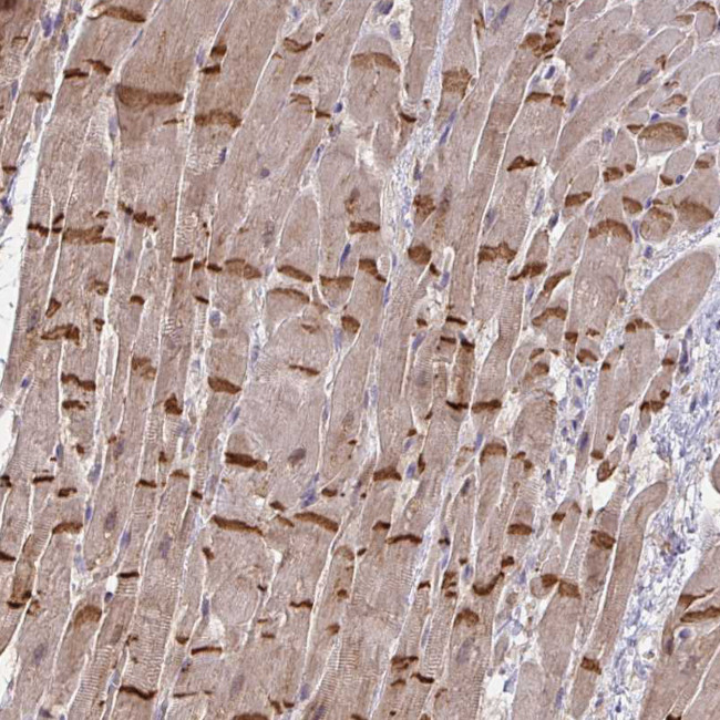 SLC9A6 Antibody in Immunohistochemistry (Paraffin) (IHC (P))