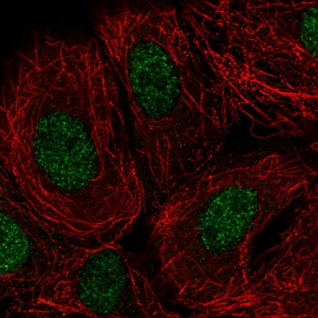 DOK7 Antibody in Immunocytochemistry (ICC/IF)