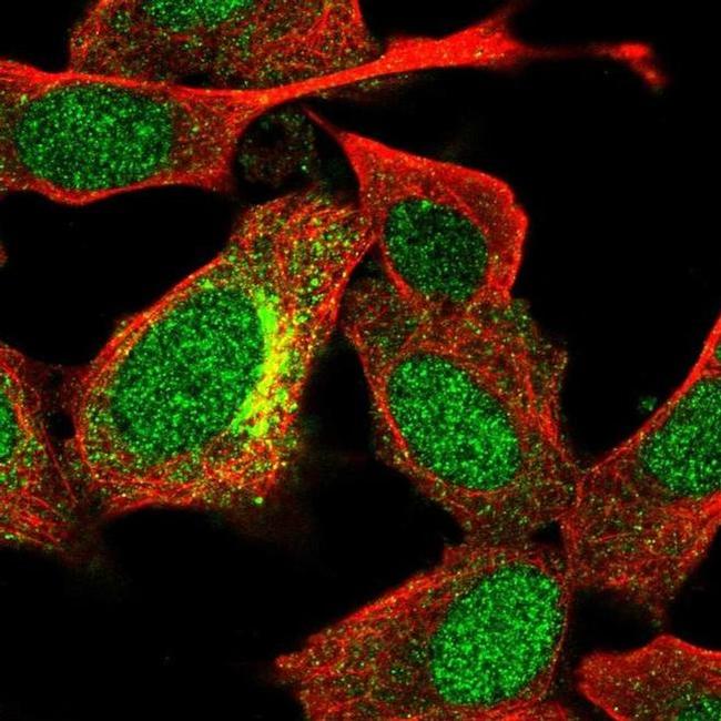 UGT3A2 Antibody in Immunocytochemistry (ICC/IF)