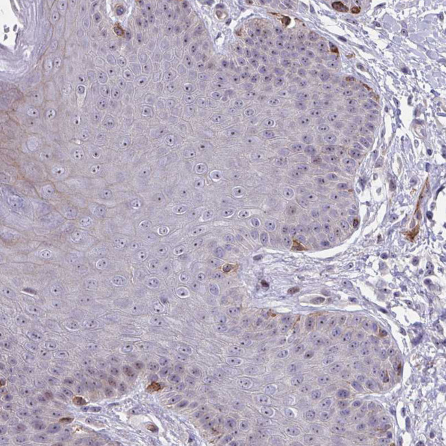 MUS81 Antibody in Immunohistochemistry (Paraffin) (IHC (P))