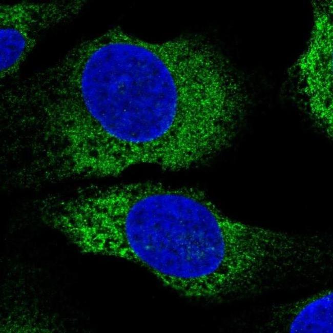 MYLK2 Antibody in Immunocytochemistry (ICC/IF)