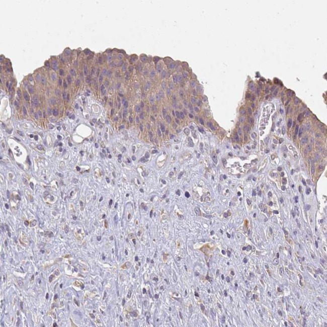 CTHRC1 Antibody in Immunohistochemistry (Paraffin) (IHC (P))