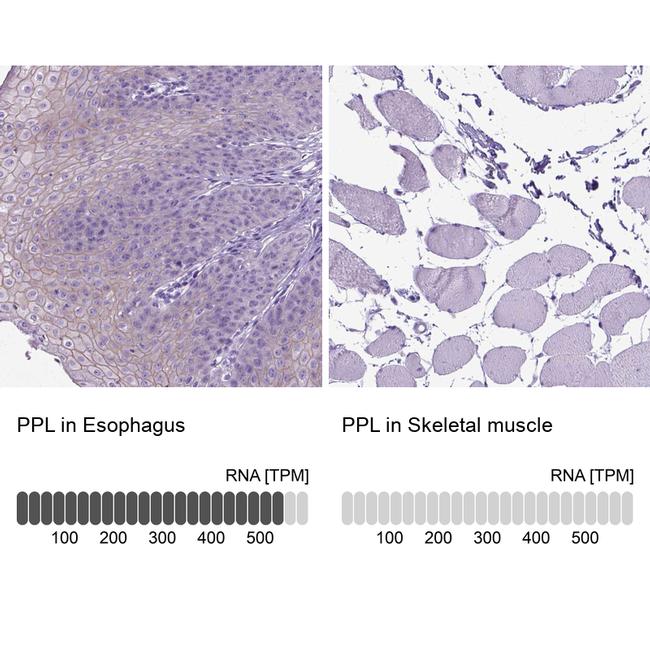 Periplakin Antibody in Immunohistochemistry (IHC)