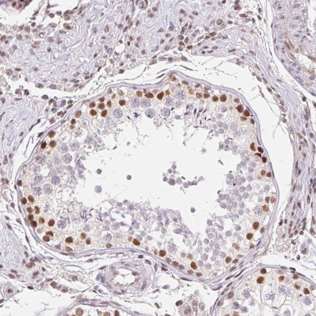 TREF1 Antibody in Immunohistochemistry (Paraffin) (IHC (P))