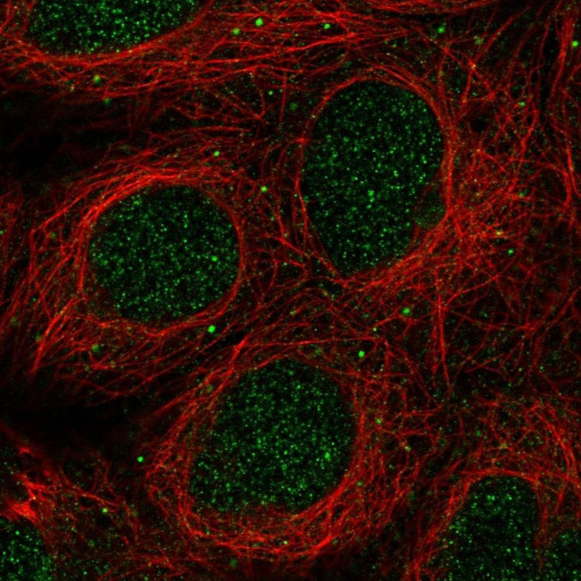 GLB1L2 Antibody in Immunocytochemistry (ICC/IF)