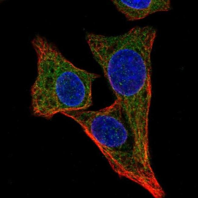 ALG1 Antibody in Immunocytochemistry (ICC/IF)