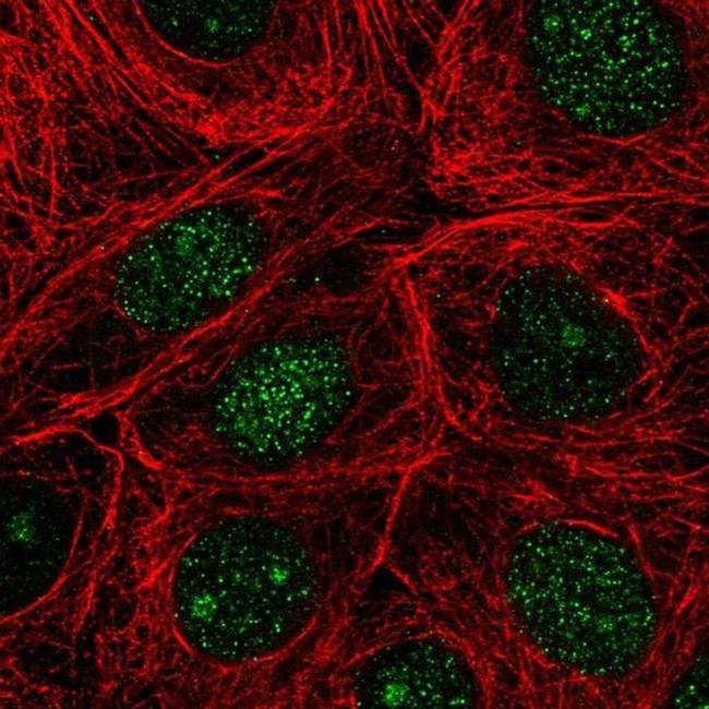 NUDT16 Antibody in Immunocytochemistry (ICC/IF)