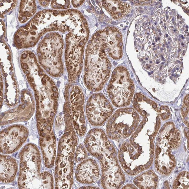 DNAJA2 Antibody in Immunohistochemistry (Paraffin) (IHC (P))