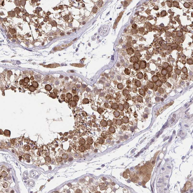 NAALAD2 Antibody in Immunohistochemistry (Paraffin) (IHC (P))