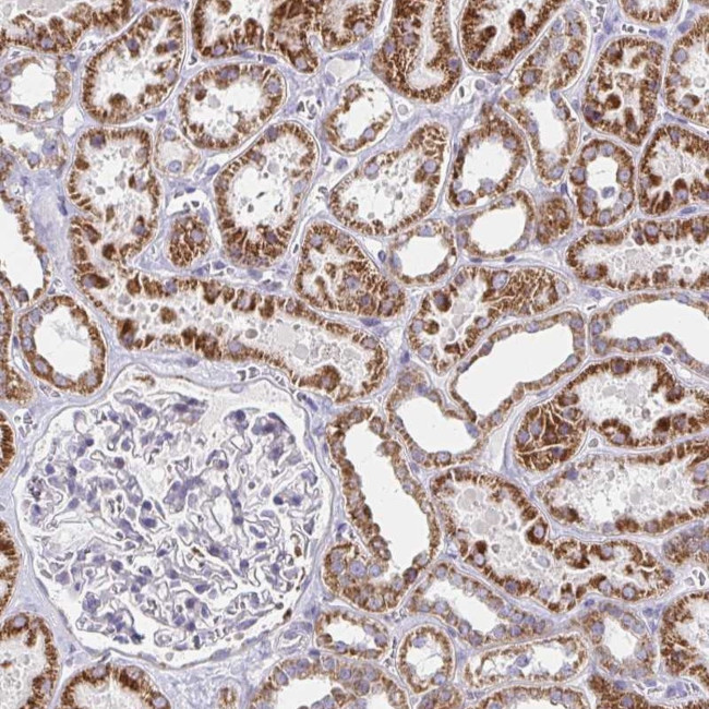 EXOC5 Antibody in Immunohistochemistry (Paraffin) (IHC (P))